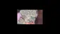 Video Thumbnail: Medicated Barber Friend