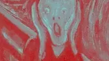 Video Reviews from UK Patients Video Thumbnail