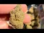 Video Thumbnail: Pain Patient