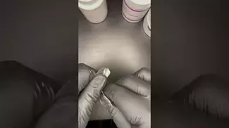 Mac doughnut by all nations UK Medical  pt1 
